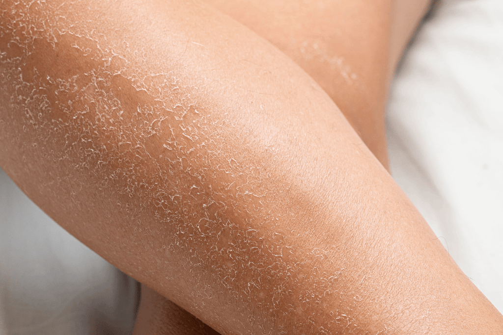 Clogged Skin Pore Woes? Here's How To Fix It