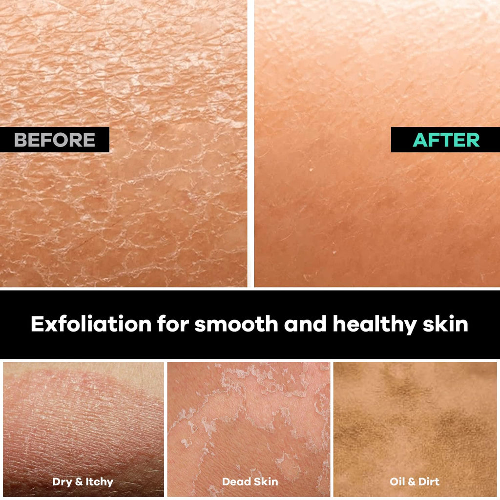 Dermasuri exfoliating back scrubber removes dry and flaky skin, leaving your back smooth and healthier.